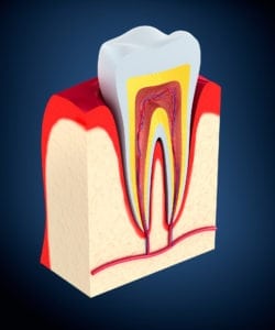 Bleeding Gums treatment in Williamsport PA