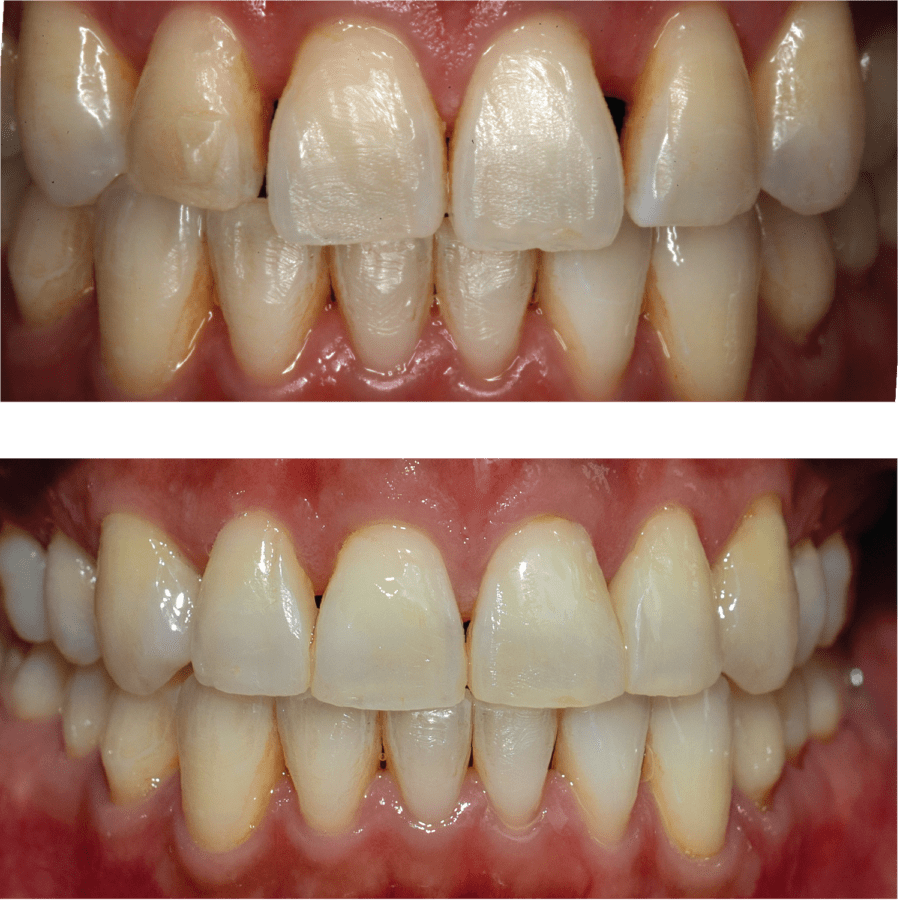 Smile Gallery Real Results Loyalsock Dental in Williamsport PA